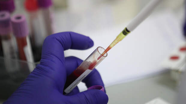 Россиянки могут сдать анализ на ВПЧ на первом этапе диспансеризации