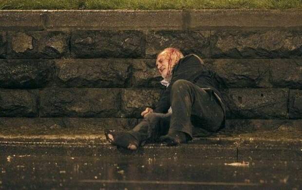 An injured protestor lies along the street in Tbilisi