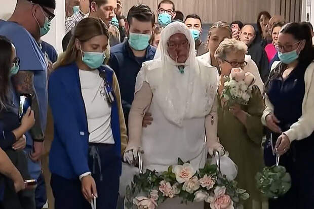 В США невеста с сильно обожженным лицом вышла замуж в больнице