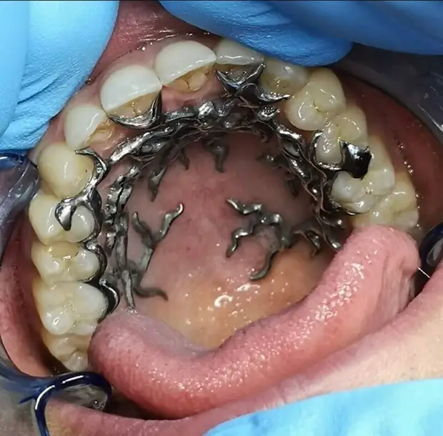 Зачем помещать драгоценности в рот?