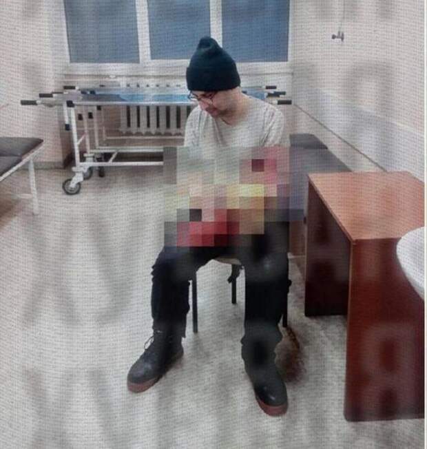 В Одессе  молодой человек попытался отпилить себе руку болгаркой чтобы избежать мобилизации