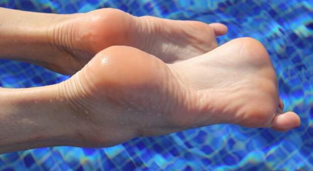 Как избавиться от натоптышей доступными домашними средствами