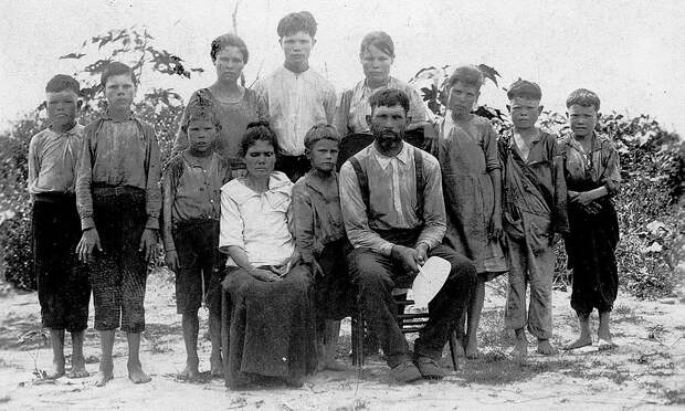 This poor white family from Alabama was presented in 1913 as "celebrities" because they had escaped the debilitating effects of hookworm disease, which, along with pellagra was endemic among Southern "white trash" due to poor sanitation and the phenomenon of "clay eating" (geophagia).