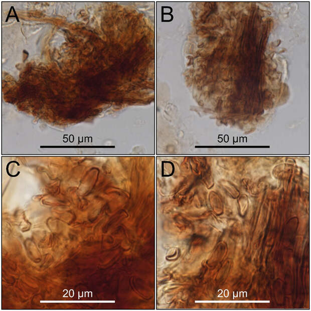 Рис. 3. Кластеры спор Gallacea scleroderma 