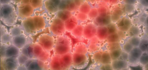 Что такое дистрофия? Виды, классификация, симптомы, лечение и причины