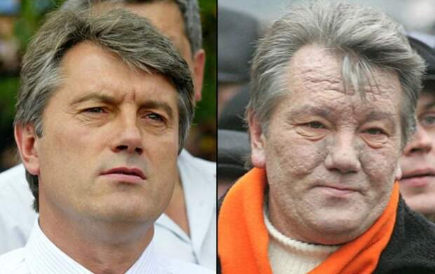 Обман об отравлении Ющенко раскрыт спустя 14 лет