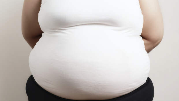 Трагический финал: участница реалити о похудении не дожила до операции