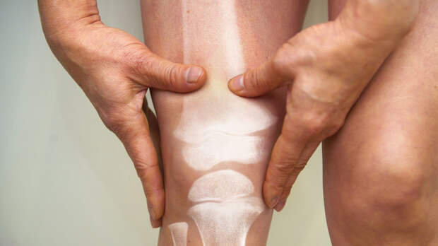 Травматолог Гедиев: хруст в суставах опасен при боли и отёке