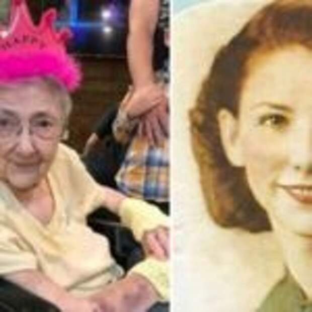 Женщина со смертельным расположением органов прожила до 99 лет
