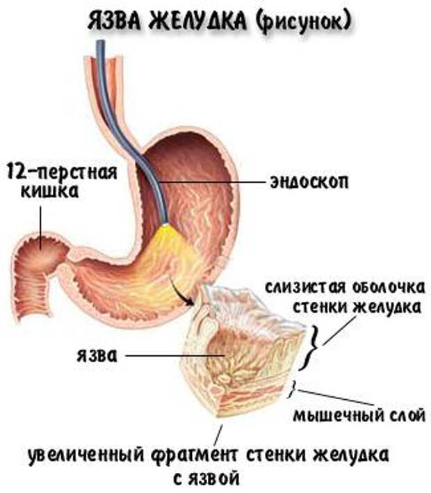 3925073_VwgLMmXy9B4 (325x372, 18Kb)