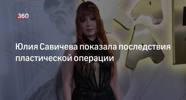 Певица Савичева показала последствия пластической операции в клипе «Девочка»