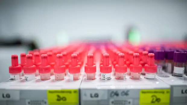 В Кировской области оценили ситуацию с COVID-19