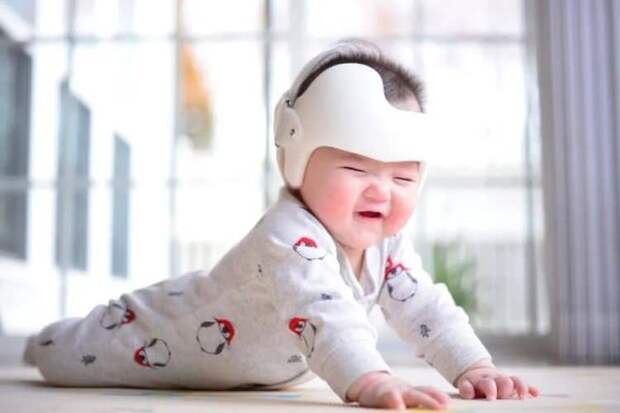 Странная китайская новинка — шлем для исправления формы головы у новорожденных