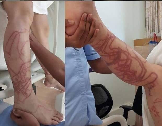 Встреча с медузой чуть не стала смертельной
