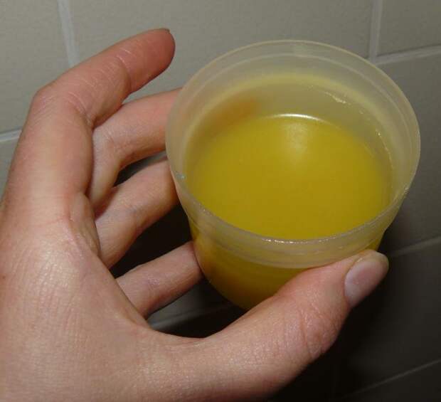 Вот чего боится грибок. Это злейший враг грибка на ногах!