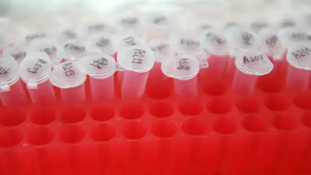 В Ульяновской области прокомментировали ситуацию с заболеваемостью COVID-19