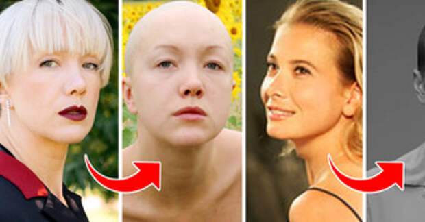 10 любимых актрис, которые отважились приглушить свою красоту ради роли