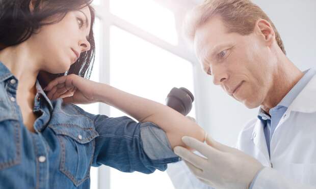 Что за система ABCDE, которая поможет отличить обычную родинку от подозрительной