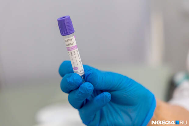 Статистики рассказали о числе людей с ВИЧ-инфекцией в Красноярском крае