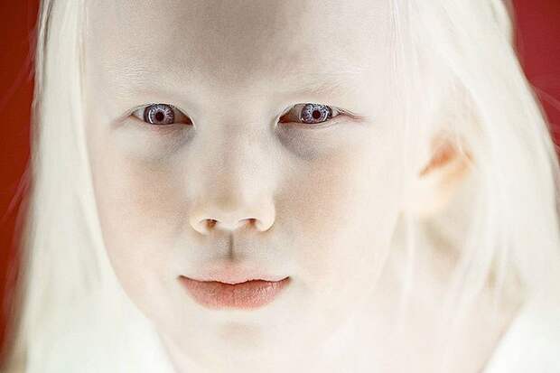 В роду Нарияны никогда раньше не было альбиносов.