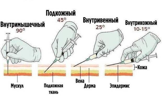 Как делать инъекции