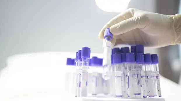 Вирусолог Волчков прокомментировал ситуацию с коронавирусом в России