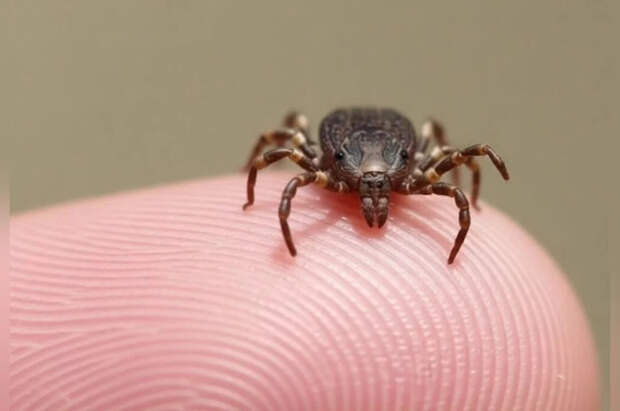 21-летний парень умер после укуса клеща