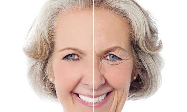 Десять главных причин морщин на лице, не связанных со старением