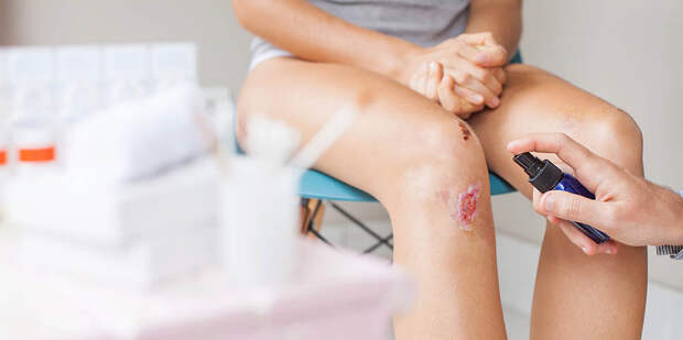 ВГУИТ: заживление ран зависит от уровня тревожности пациента