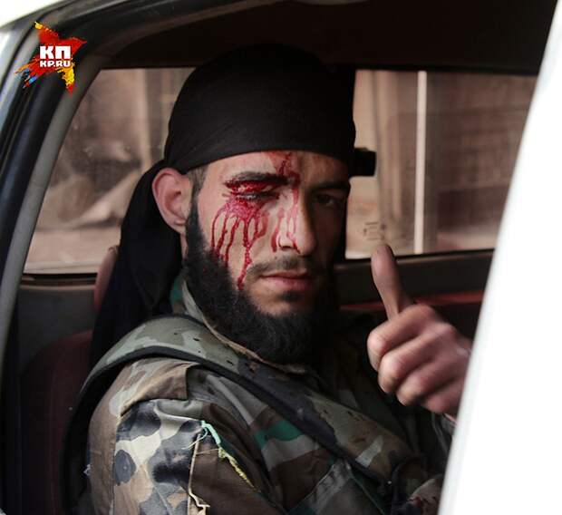 Сирийский военный получил ранение в столкновении с боевиками Фото: Александр КОЦ