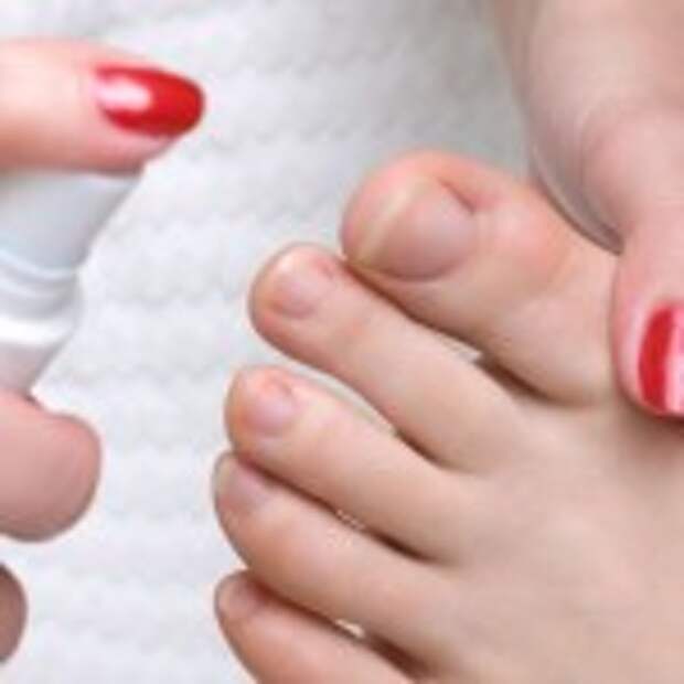 Lechenie gribka nogtey 2 150x150 Грибок ногтей на ногах — причины, симптомы, профилактика, лечение, что важно знать