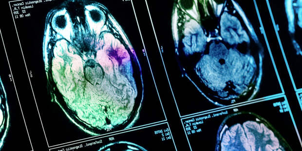 Богатство и мозг. Как доход влияет на нейронную активность у мужчин