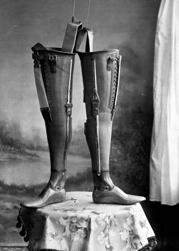Гений протезов Джеймс Джиллингем – английский сапожник, который ошеломил медицинский мир протез, сапожник