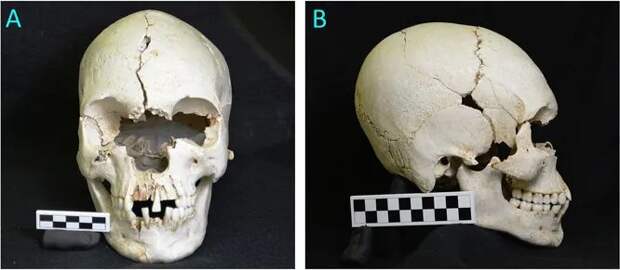 археология, история