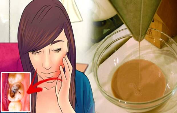 learn-how-to-relieve-toothache-in-just-1-minute-using-this-natural-remedy