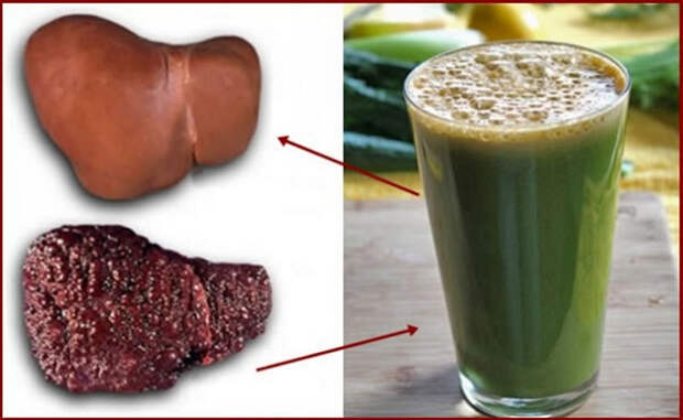 clean-your-fatty-liver-with-this-beverage-recipe
