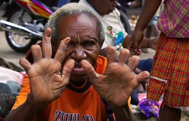 Странная традиция: отрезание пальцев в племени Дани.