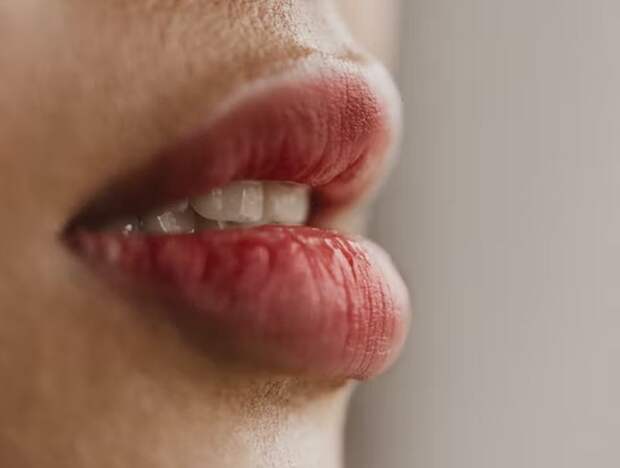 Потрескавшиеся губы могут быть симптомом внутреннего воспаления