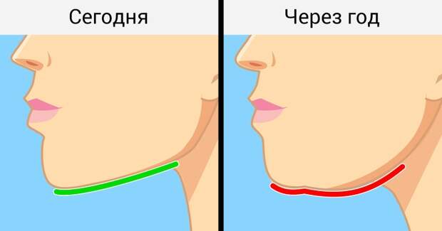Чем опасен синдром компьютерной шеи и как избежать необратимых для здоровья последствий