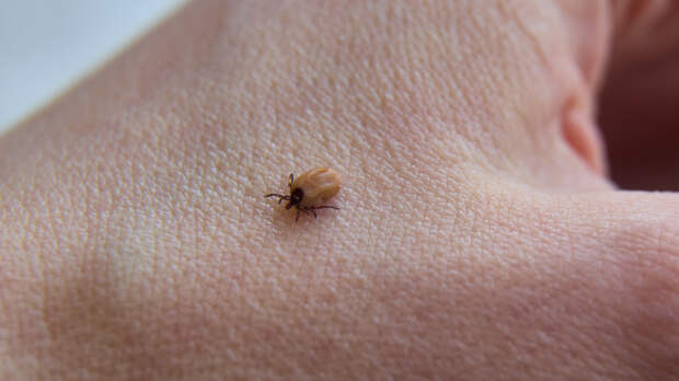 «Отсрочка увеличивает риск»: как действовать при укусе клеща у ребенка