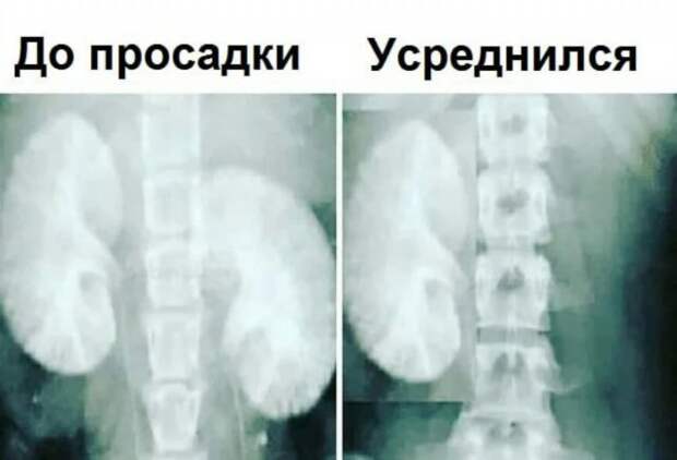 Шутки и мемы от людей, которые считают себя инвестором