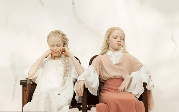 Уникальная красота девочек-альбиносов. Фото: Vinicius Terranova.