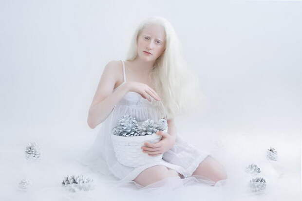 Красота альбиносов в фотографиях Yulia Taits