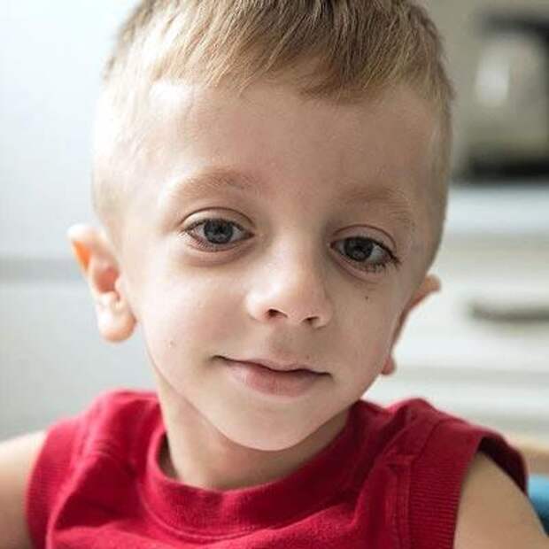 Артем Несин, 6 лет, несовершенный остеогенез, спасет операция, 1 069 160 ₽