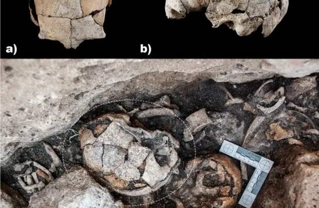 На черепе возрастом 5300 лет археологи обнаружили следы первой известной операции на ухе