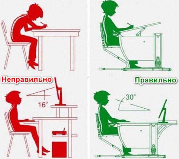 Профилактика сколиоза. Профилактика осанки у детей. Вторичная профилактика сколиоза. Профилактика сколиоза у школьников памятка.