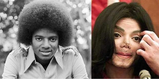 13. Певец Майкл Джексон известные люди, пластические операции до и после