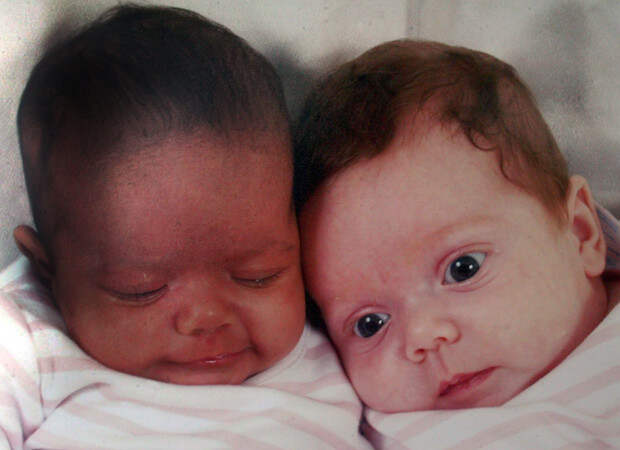 Джеймс и Дэниел близнецы, расы, факты, фото