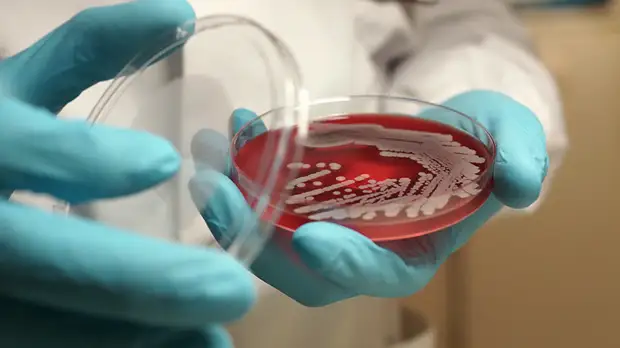 «В стране происходит катастрофа»: как на Украине возникают вспышки сибирской язвы