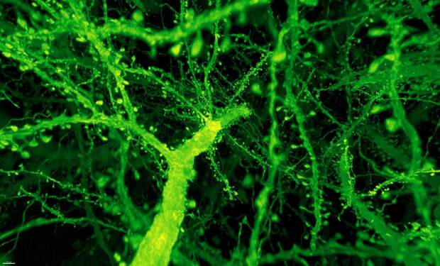 Gao et al dendritic spines